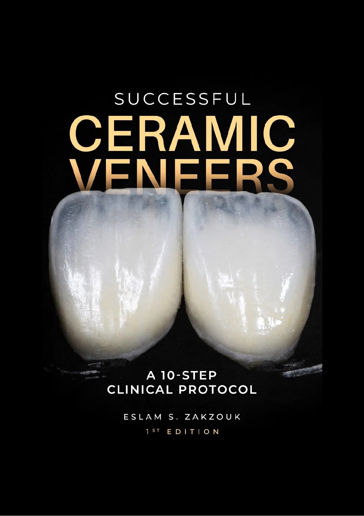 Successful Ceramic Veneers: 10 Steps Clinical Protocol