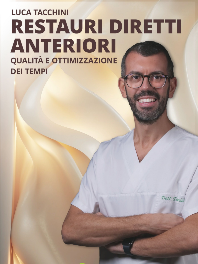 Restauri Diretti Anteriori