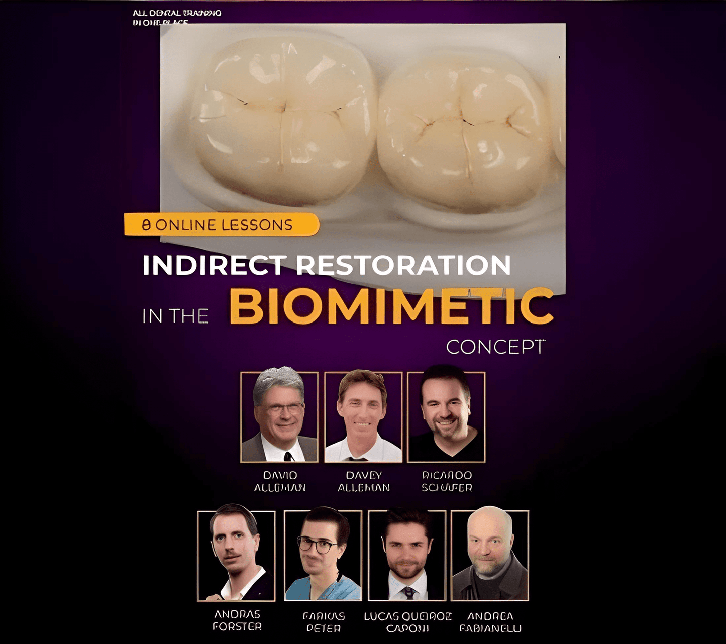 Indirect Restoration in the Biomimetic Concept