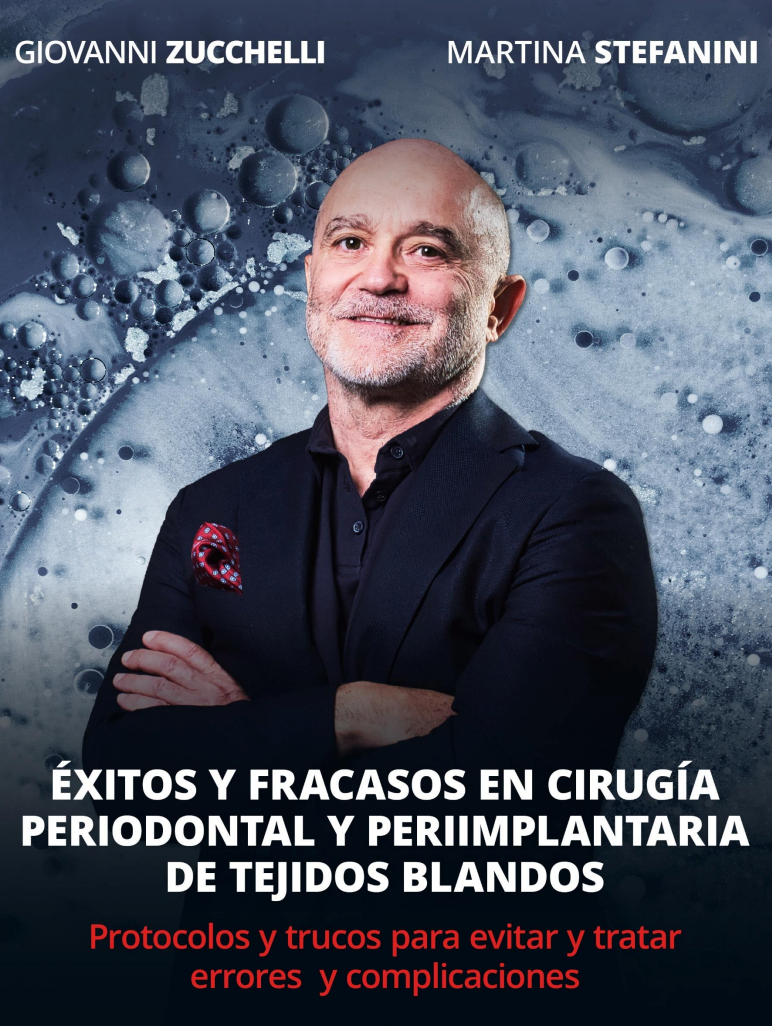 Exitos y fracasos en cirugía periodontal y periimplantaria de tejidos blandos