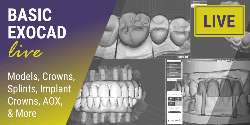 BASIC EXOCAD: Models, Crowns, Splints, Implant Crowns, AOX, &amp; More