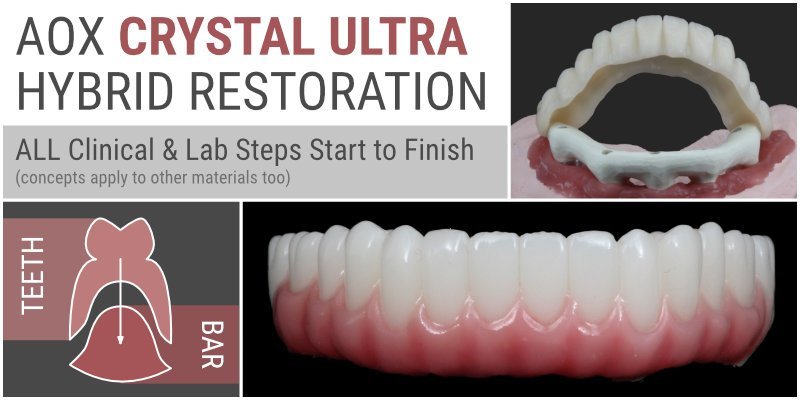 AOX Crystal Ultra Hybrid Restoration – ALL Clinical &amp; Lab Steps Start to Finish