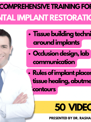 Implant Restorations Simplified: Restore Dental Implants with Accuracy &amp; Confidence (Surgical Master)