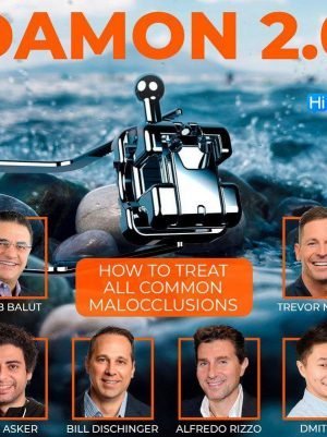 Damon 2.0. How to Treat all Common Malocclusions
