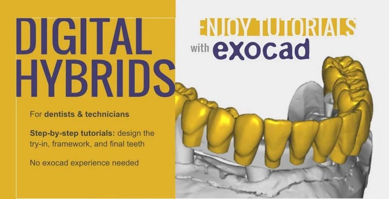 Digital Hybrids for Dentists &amp; Technicians