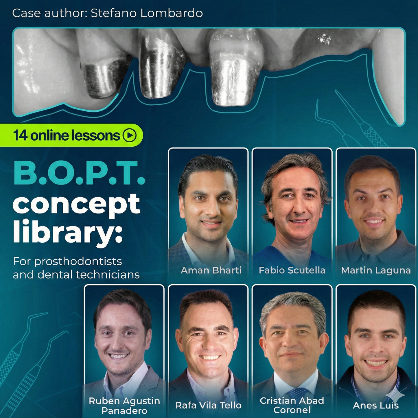 B.O.P.T. Concept Encyclopedia For Prosthodontists and Dental Technicians