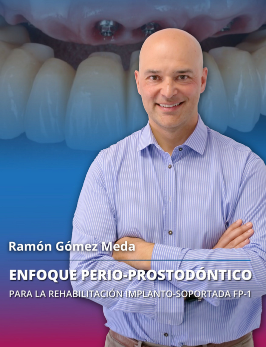 Enfoque perio prostodontico para la rehabilitacion implanto soportada FP 1